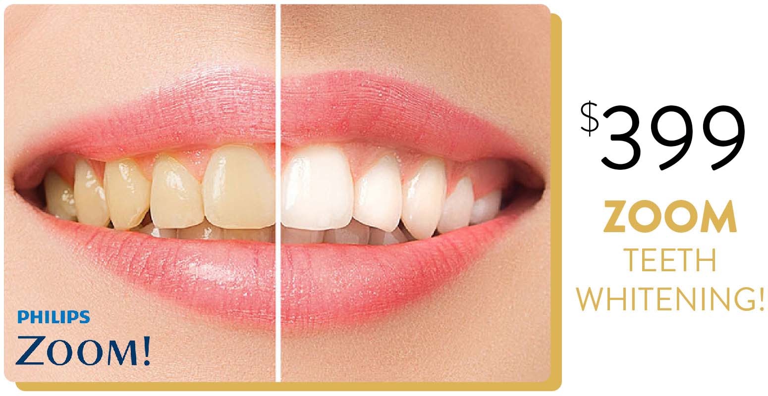 $399 Zoom Teeth Whitening